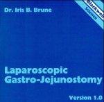 Algopix Similar Product 6 - Laparoscopic Gastro-Jejunostomy CD-ROM