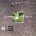 Algopix Similar Product 7 - Laparoscopic Bowel Resection Featuring