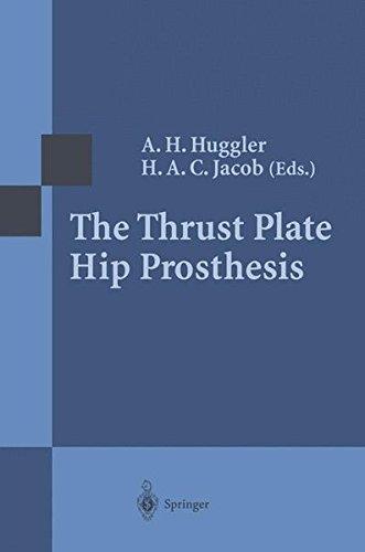 Algopix Similar Product 17 - The Thrust Plate Hip Prosthesis