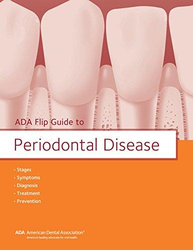 Algopix Similar Product 9 - ADA Flip Guide to Periodontal Disease