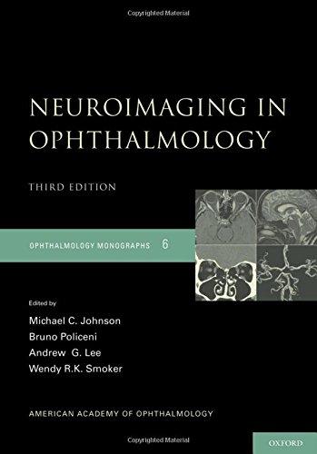 Algopix Similar Product 5 - Neuroimaging in Ophthalmology American