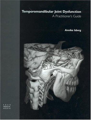 Algopix Similar Product 17 - Temporomandibular Joint Dysfunction A