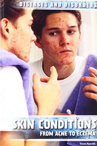 Algopix Similar Product 9 - Skin Conditions From Acne to Eczema