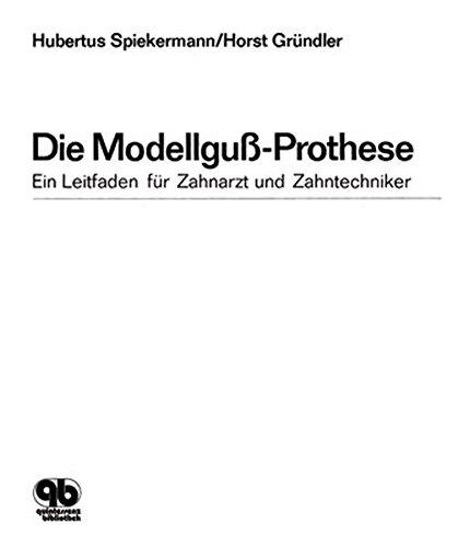 Algopix Similar Product 3 - Die ModellgussProthese Ein Leitfaden