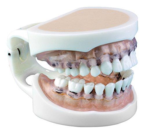 Algopix Similar Product 14 - Practicon 4112174 Bone Furcation Model