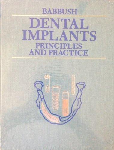 Algopix Similar Product 1 - Dental Implants: Principles and Practice