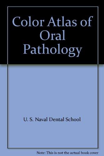 Algopix Similar Product 19 - Color Atlas of Oral Pathology