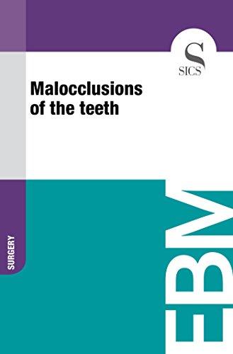 Algopix Similar Product 12 - Malocclusions of the Teeth