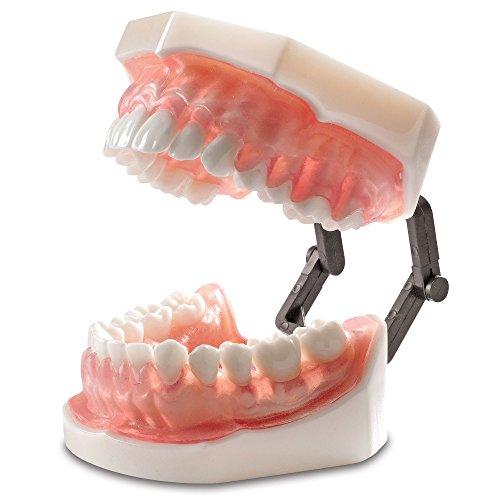Algopix Similar Product 18 - Practicon 4112125 Bone Absorption Model