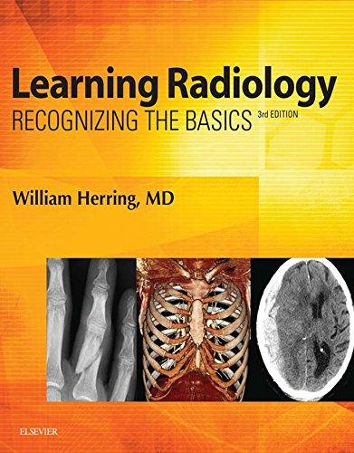 Algopix Similar Product 1 - Learning Radiology EBook Recognizing