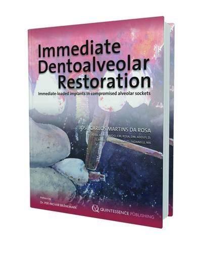 Algopix Similar Product 10 - Immediate Dentoalveolar Restoration