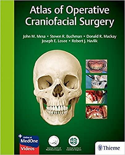 Algopix Similar Product 20 - Atlas of Operative Craniofacial Surgery
