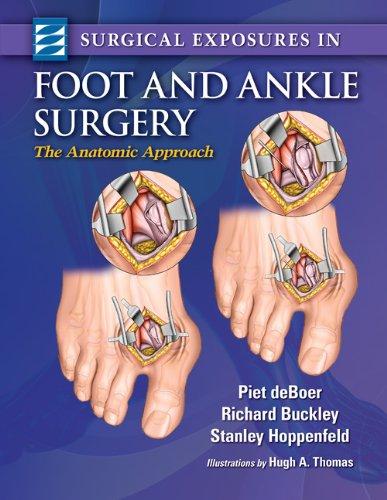 Algopix Similar Product 3 - Surgical Exposures in Foot  Ankle