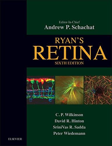 Algopix Similar Product 4 - Ryan's Retina E-Book