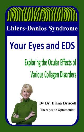 Algopix Similar Product 10 - EhlersDanlos Syndrome Your Eyes and