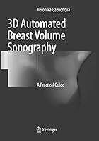 Algopix Similar Product 19 - 3D Automated Breast Volume Sonography