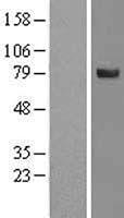 Algopix Similar Product 20 - SPATA20 Overexpression Lysate