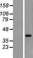 Algopix Similar Product 13 - Archaemetzincin 2 Overexpression Lysate