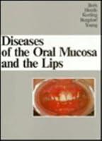 Algopix Similar Product 3 - Diseases of the Oral Mucosa and the Lips