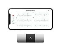 Algopix Similar Product 6 - KardiaMobile 6Lead Personal EKG