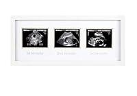 Algopix Similar Product 4 - Pearhead Sonogram Progression Frame 