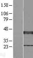 Algopix Similar Product 2 - XRCC3 Overexpression Lysate