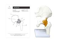 Algopix Similar Product 10 - Hip Joint Anatomical Cast Scientific