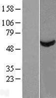 Algopix Similar Product 9 - TBCE Overexpression Lysate