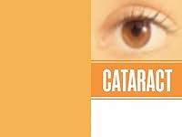 Algopix Similar Product 6 - Cataract