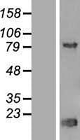 Algopix Similar Product 16 - Thyroid receptorInteracting Protein 13
