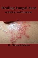 Algopix Similar Product 15 - Healing Fungal Acne Guidelines and