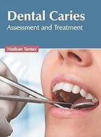 Algopix Similar Product 17 - Dental Caries: Assessment and Treatment