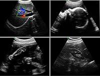 Algopix Similar Product 9 - Wireless Wifi Convex Array Probe Type