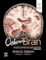 Algopix Similar Product 7 - Osborn's Brain