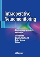 Algopix Similar Product 8 - Intraoperative Neuromonitoring