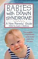 Algopix Similar Product 10 - Babies With Down Syndrome A New