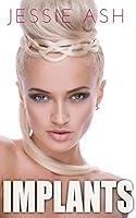 Algopix Similar Product 1 - Implants
