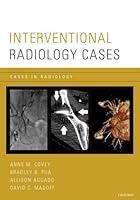 Algopix Similar Product 10 - Interventional Radiology Cases Cases