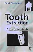 Algopix Similar Product 13 - Tooth Extraction: A Practical Guide