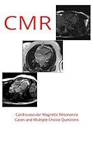 Algopix Similar Product 12 - CMR  Cardiovascular Magnetic Resonance