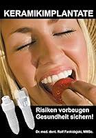 Algopix Similar Product 16 - Keramikimplantate Risiken vorbeugen