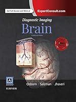 Algopix Similar Product 15 - Diagnostic Imaging: Brain