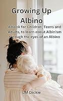 Algopix Similar Product 18 - Growing Up Albino A Book for Children