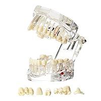 Algopix Similar Product 9 - Dentalmall Dental Oral Typodont Model