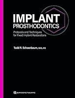 Algopix Similar Product 13 - Implant Prosthodontics Protocols and