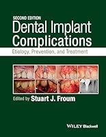 Algopix Similar Product 15 - Dental Implant Complications Etiology