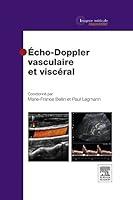 Algopix Similar Product 19 - EchoDoppler vasculaire et viscral