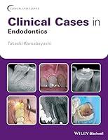 Algopix Similar Product 16 - Clinical Cases in Endodontics Clinical