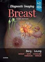 Algopix Similar Product 3 - Diagnostic Imaging: Breast