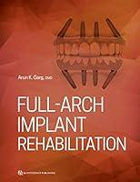 Algopix Similar Product 9 - Full-Arch Implant Rehabilitation